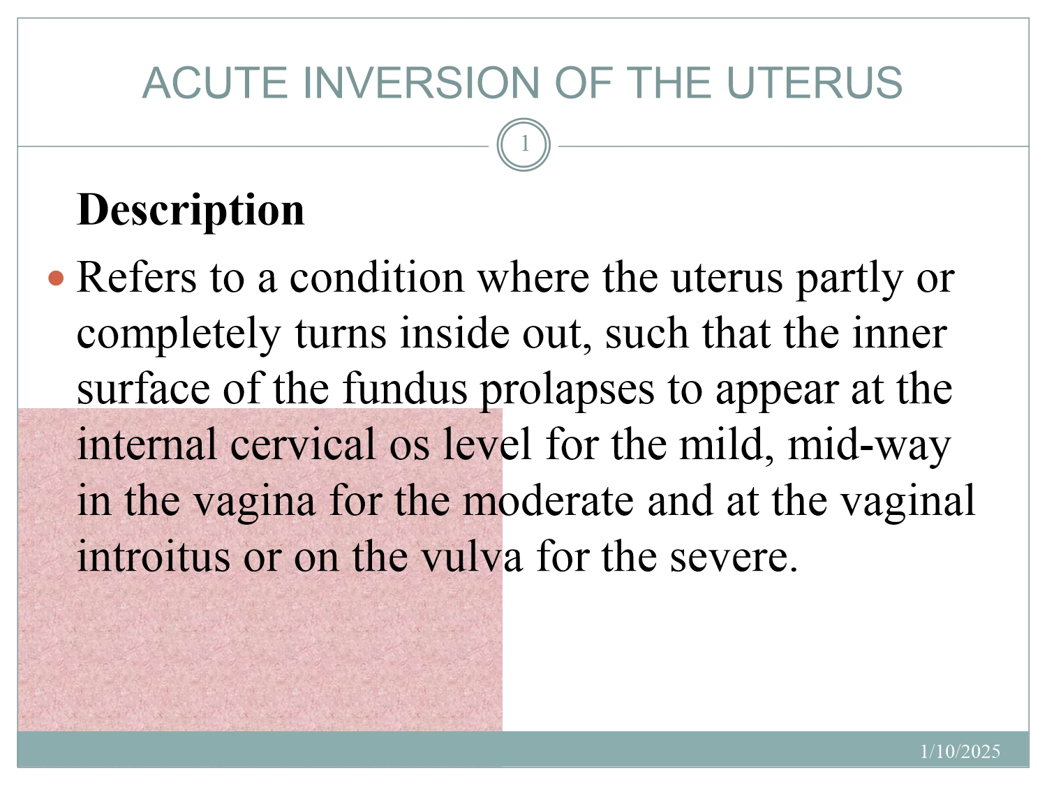 No preview available